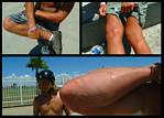(38) injury montage.jpg    (1000x720)    306 KB                              click to see enlarged picture